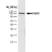 Anti Poly(ADP-Ribose) Polymerase-1 Antibody, clone A6.4.12 thumbnail image 1