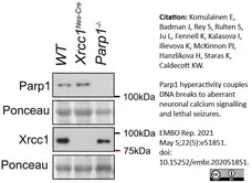 Anti Poly(ADP-Ribose) Polymerase-1 Antibody, clone A6.4.12 gallery image 10