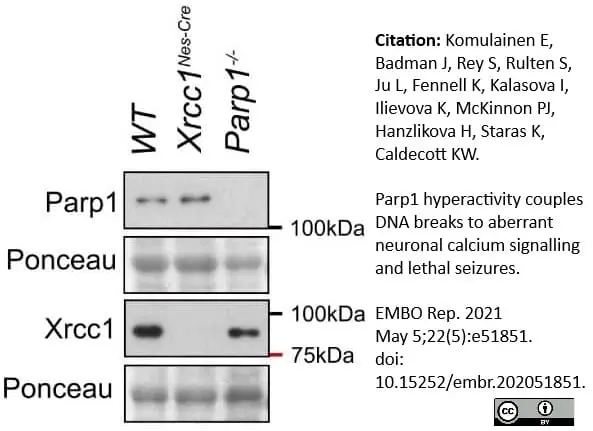 Anti Poly(ADP-Ribose) Polymerase-1 Antibody, clone A6.4.12 gallery image 10