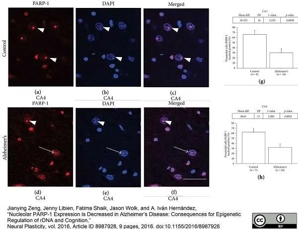 Anti Poly(ADP-Ribose) Polymerase-1 Antibody, clone A6.4.12 gallery image 4