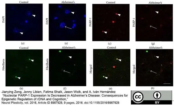 Anti Poly(ADP-Ribose) Polymerase-1 Antibody, clone A6.4.12 gallery image 5