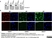 Anti Poly(ADP-Ribose) Polymerase-1 Antibody, clone A6.4.12 thumbnail image 7