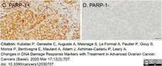 Anti Poly(ADP-Ribose) Polymerase-1 Antibody, clone A6.4.12 gallery image 9