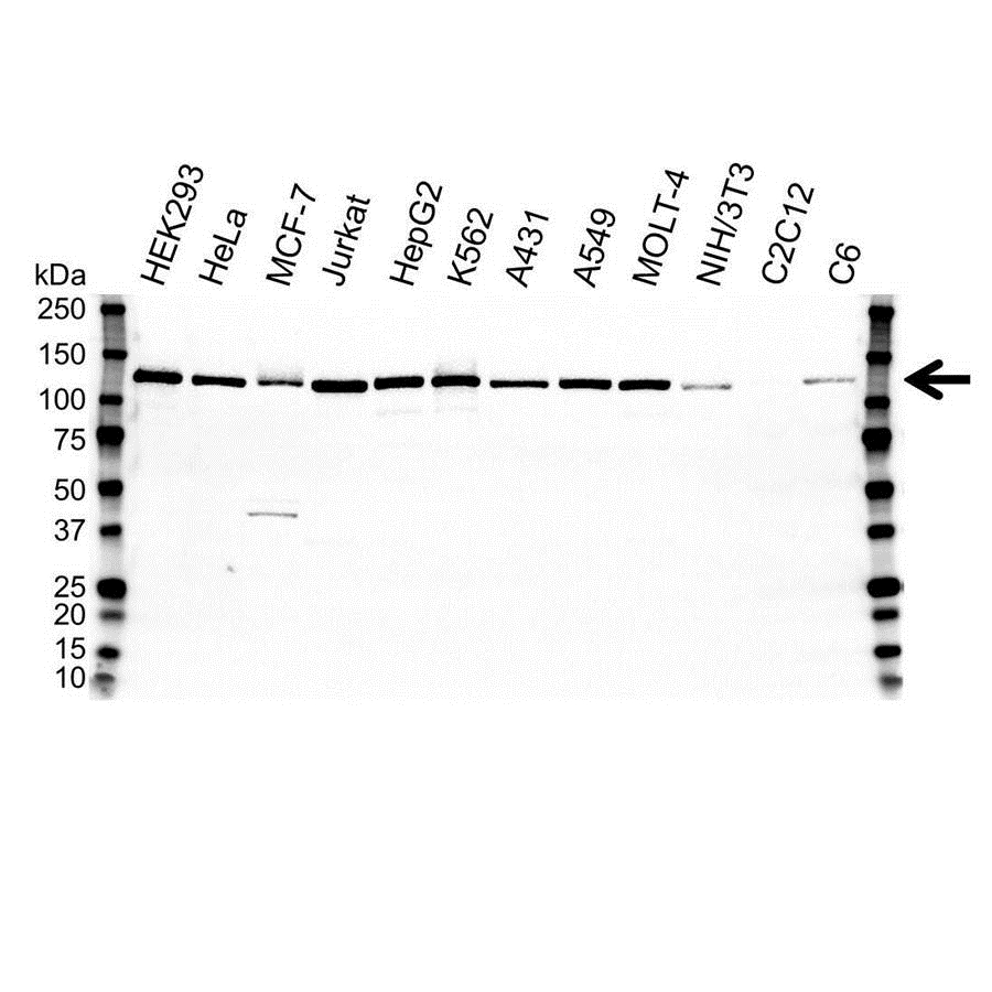 Anti Poly (ADP-Ribose) Polymerase 1 Antibody, clone A6.4.12 (PrecisionAb Monoclonal Antibody) gallery image 1