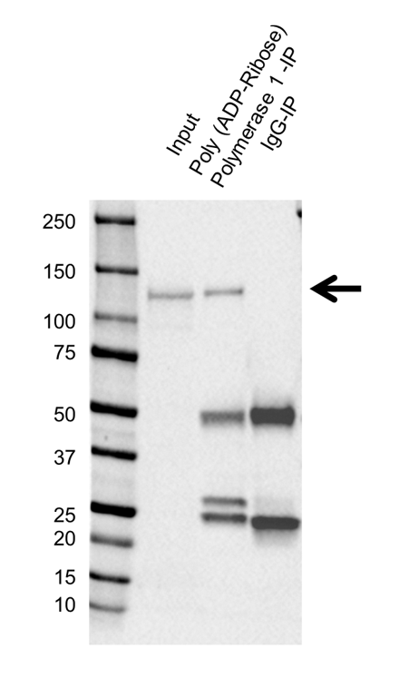 Anti Poly (ADP-Ribose) Polymerase 1 Antibody, clone A6.4.12 (PrecisionAb Monoclonal Antibody) gallery image 2