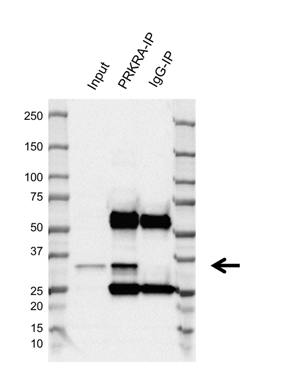 Anti Prkra Antibody, clone AB01/1C8 (PrecisionAb Monoclonal Antibody) gallery image 2