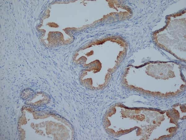 Anti Human Prostate Specific Antigen Antibody, clone 58.8H10 gallery image 1