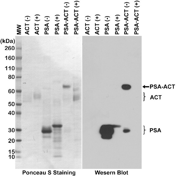 Anti Prostate Specific Antigen Antibody, clone RM323 gallery image 1
