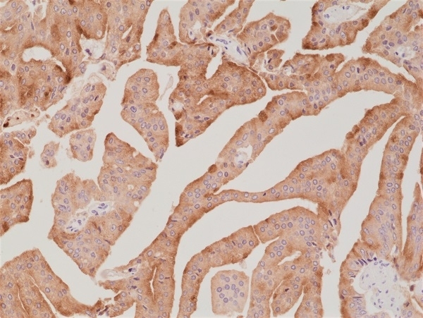 Anti Prostate Specific Antigen Antibody, clone RM323 gallery image 2
