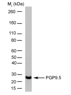 Anti Human Protein Gene Product 9.5 Antibody, clone 13C4 gallery image 1