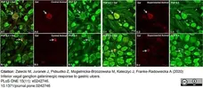 Anti Human Protein Gene Product 9.5 Antibody, clone 13C4 gallery image 11