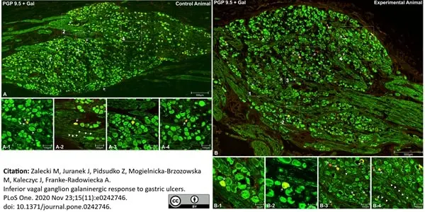 Anti Human Protein Gene Product 9.5 Antibody, clone 13C4 gallery image 12