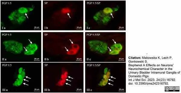 Anti Human Protein Gene Product 9.5 Antibody, clone 13C4 gallery image 15
