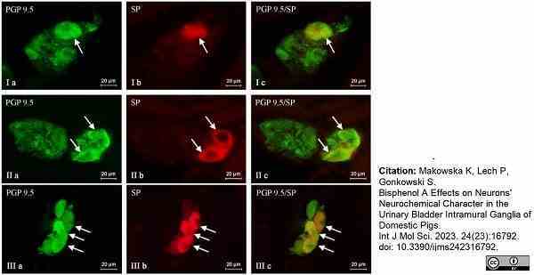 Anti Human Protein Gene Product 9.5 Antibody, clone 13C4 gallery image 16
