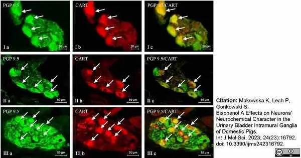 Anti Human Protein Gene Product 9.5 Antibody, clone 13C4 gallery image 17