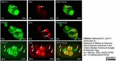 Anti Human Protein Gene Product 9.5 Antibody, clone 13C4 gallery image 18