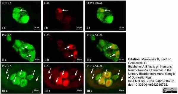 Anti Human Protein Gene Product 9.5 Antibody, clone 13C4 gallery image 18