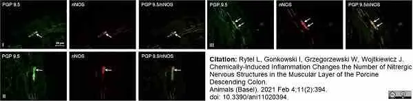 Anti Human Protein Gene Product 9.5 Antibody, clone 13C4 gallery image 19