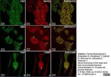 Anti Human Protein Gene Product 9.5 Antibody, clone 13C4 gallery image 20