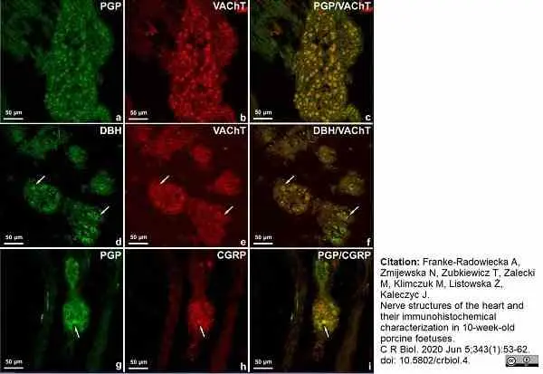 Anti Human Protein Gene Product 9.5 Antibody, clone 13C4 gallery image 20