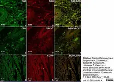 Anti Human Protein Gene Product 9.5 Antibody, clone 13C4 gallery image 21