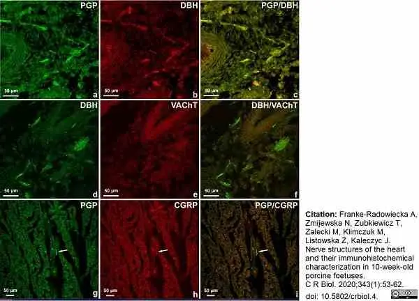 Anti Human Protein Gene Product 9.5 Antibody, clone 13C4 gallery image 21