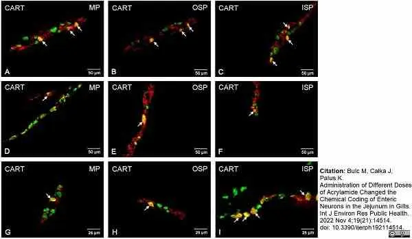 Anti Human Protein Gene Product 9.5 Antibody, clone 13C4 gallery image 22