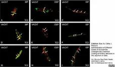 Anti Human Protein Gene Product 9.5 Antibody, clone 13C4 gallery image 23