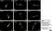 Anti Human Protein Gene Product 9.5 Antibody, clone 13C4 thumbnail image 23