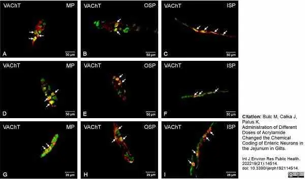 Anti Human Protein Gene Product 9.5 Antibody, clone 13C4 gallery image 23