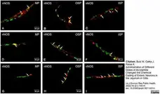 Anti Human Protein Gene Product 9.5 Antibody, clone 13C4 gallery image 24