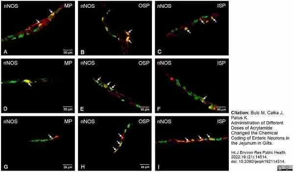 Anti Human Protein Gene Product 9.5 Antibody, clone 13C4 gallery image 24