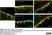 Anti Human Protein Gene Product 9.5 Antibody, clone 13C4 thumbnail image 25