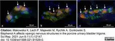 Anti Human Protein Gene Product 9.5 Antibody, clone 13C4 gallery image 28