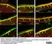 Anti Human Protein Gene Product 9.5 Antibody, clone 13C4 thumbnail image 32