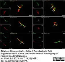 Anti Human Protein Gene Product 9.5 Antibody, clone 13C4 gallery image 36