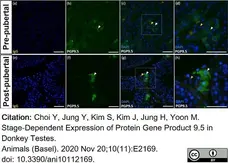 Anti Human Protein Gene Product 9.5 Antibody, clone 13C4 gallery image 4