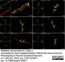 Anti Human Protein Gene Product 9.5 Antibody, clone 13C4 gallery image 40