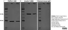 Anti Human Protein Gene Product 9.5 Antibody, clone 13C4 gallery image 5
