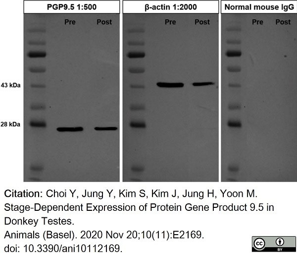 Anti Human Protein Gene Product 9.5 Antibody, clone 13C4 gallery image 5