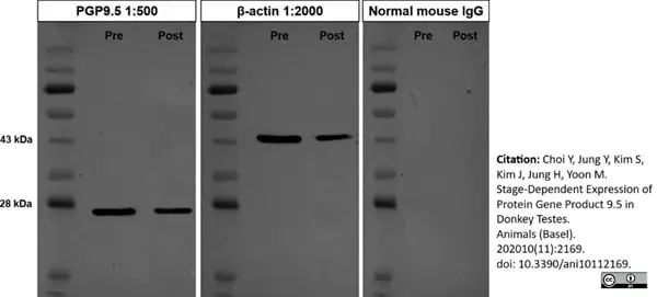 Anti Human Protein Gene Product 9.5 Antibody, clone 13C4 gallery image 5