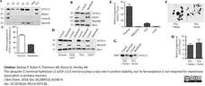 Anti Human Protein Gene Product 9.5 Antibody, clone 31A3 (Monoclonal Antibody Antibody) gallery image 1