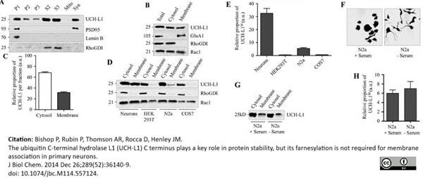 Anti Human Protein Gene Product 9.5 Antibody, clone 31A3