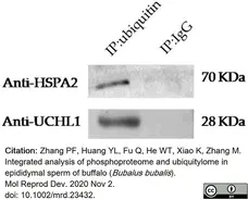 Anti Human Protein Gene Product 9.5 Antibody, clone 31A3 (Monoclonal Antibody Antibody) gallery image 10
