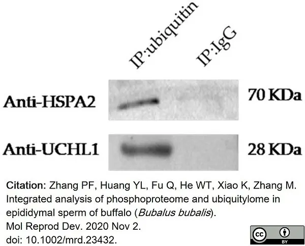 Anti Human Protein Gene Product 9.5 Antibody, clone 31A3 (Monoclonal Antibody Antibody) gallery image 10
