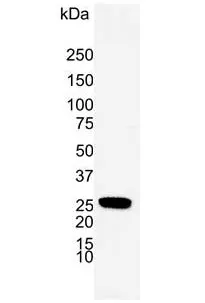 Anti Human Protein Gene Product 9.5 Antibody, clone 31A3 (Monoclonal Antibody Antibody) gallery image 11