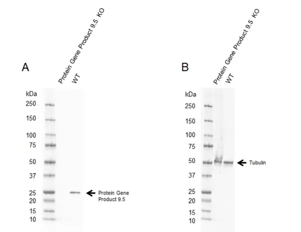 Anti Human Protein Gene Product 9.5 Antibody, clone 31A3 (Monoclonal Antibody Antibody) gallery image 12