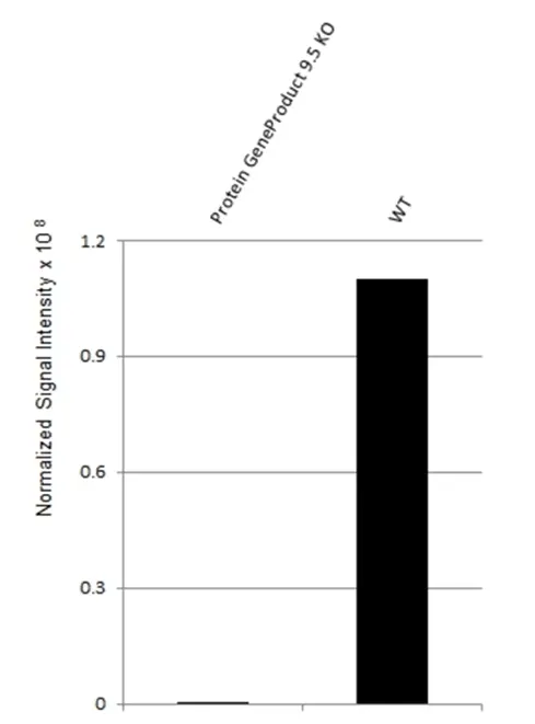 Anti Human Protein Gene Product 9.5 Antibody, clone 31A3 (Monoclonal Antibody Antibody) gallery image 13