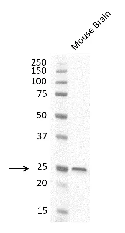 Anti Human Protein Gene Product 9.5 Antibody, clone 31A3 (Monoclonal Antibody Antibody) gallery image 14