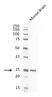 Anti Human Protein Gene Product 9.5 Antibody, clone 31A3 (Monoclonal Antibody Antibody) thumbnail image 14